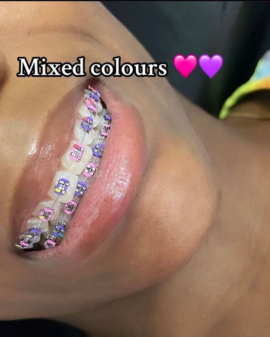 Fashion braces